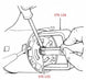 Steering Column Lock Plate Retaining Ring Removal, Angle 2